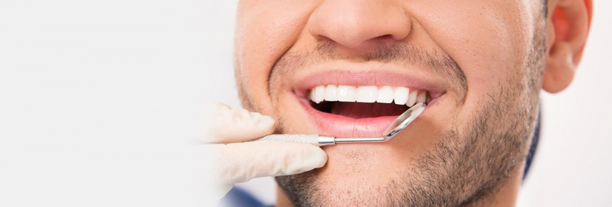 Porselen Diş Kaplama